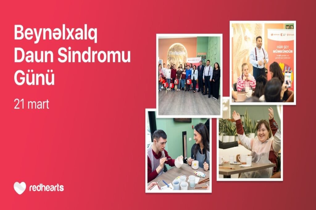 “Hər şey mümkündür”: İnklüziv inkişafı dəstəkləyən master-klass təşkil olunub