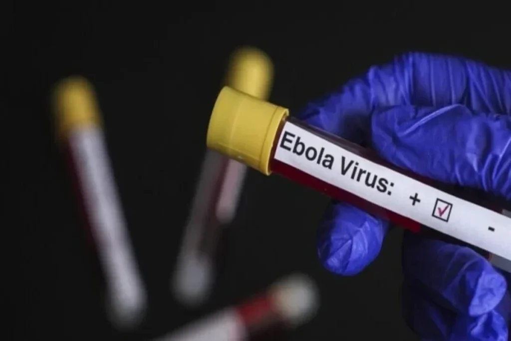 ÜST Ebola virusu riski altında olan ölkələri açıqlayıb
