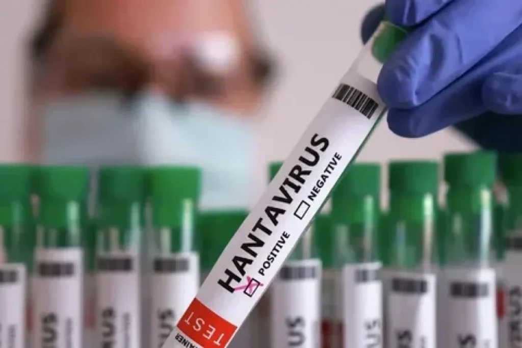 Çilidə hantavirus səbəbindən sanitar həyəcan rejimi elan edilib